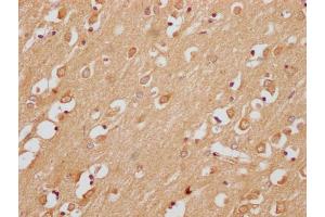 IHC image of ABIN7174940 diluted at 1:200 and staining in paraffin-embedded human brain tissue performed on a Leica BondTM system. (Uncharacterized Protein SMIM29 (SMIM29) (AA 42-102) Antikörper)