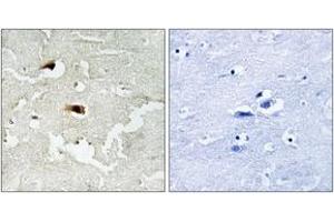 Immunohistochemistry analysis of paraffin-embedded human brain tissue, using NF-kappaB p65 (Ab-536) Antibody.