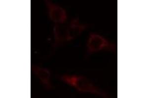 ABIN6274414 staining A549 cells by IF/ICC. (ADCK1 Antikörper  (Internal Region))