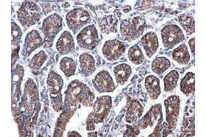 Immunohistochemistry (IHC) image for anti-Prohibitin (PHB) antibody (ABIN2854938)