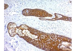 Formalin-fixed, paraffin-embedded human Skin stained with Cytokeratin, HMW Monoclonal Antibody (KRTH/1076). (Cytokeratin 2 Antikörper)