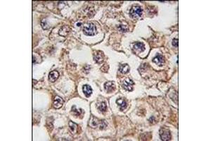 Image no. 1 for anti-Insulin Receptor-Related Receptor (INSRR) (N-Term) antibody (ABIN359888) (INSRR Antikörper  (N-Term))