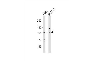 Western blot analysis of lysates from Hela, MCF-7 cell line (from left to right), using EPHA4 Antibody (Center) (ABIN6243787 and ABIN6577677). (EPH Receptor A4 Antikörper  (AA 417-451))
