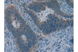 Immunohistochemistry (IHC) image for anti-Collagen, Type IV, alpha 1 (COL4A1) (AA 1444-1669) antibody (ABIN7431209)
