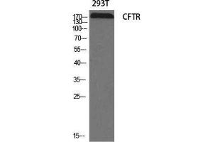 Western Blot (WB) analysis of specific cells using CFTR Polyclonal Antibody. (CFTR Antikörper  (Ser246))