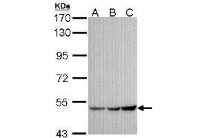 WB Image Sample (30 ug of whole cell lysate) A:A431 , B: H1299 C: Hela 7. (KCNJ3 Antikörper  (Center))