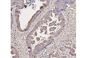 IHC analysis of COX IV using anti-COX IV antibody (ABIN7602090). (COX IV Antikörper  (AA 59-169))