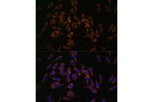 Immunofluorescence analysis of L929 cells using RPS13 antibody (ABIN7270012) at dilution of 1:100.