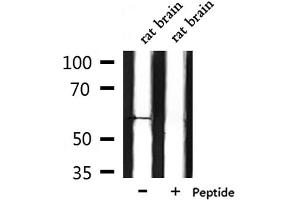 Western blot analysis of extracts from rat brain, using CHRM5 Antibody. (CHRM5 Antikörper  (C-Term))