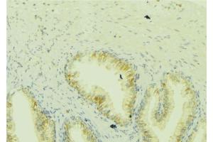 ABIN6273049 at 1/100 staining Mouse colon tissue by IHC-P. (ICT1 Antikörper)
