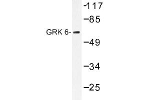 Image no. 1 for anti-G Protein-Coupled Receptor Kinase 6 (GRK6) antibody (ABIN272191) (GRK6 Antikörper)