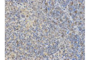 Immunohistochemistry (IHC) image for anti-Neural Wiskott-Aldrich syndrome protein (WASL) antibody (ABIN1875345) (Neural Wiskott-Aldrich syndrome protein (WASL) Antikörper)