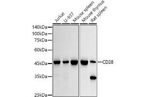 Western blot analysis of extracts of various cell lines, using CD28 antibody (ABIN7266183) at 1:1000 dilution.