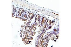 IHC analysis of EIF4A using anti-EIF4A antibody (ABIN7601309). (EIF4A1 Antikörper  (AA 32-406))