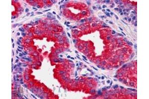 Immunohistochemistry (IHC) image for anti-Dual Specificity Phosphatase 1 (DUSP1) (C-Term) antibody (ABIN184638)