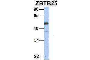 Host:  Rabbit  Target Name:  ZBTB25  Sample Type:  Human Fetal Heart  Antibody Dilution:  1. (ZBTB25 Antikörper  (Middle Region))