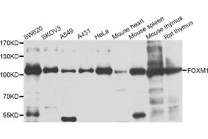 Western blot analysis of extracts of various cell lines, using FOXM1 antibody. (FOXM1 Antikörper)