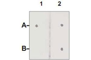 Dot Blot : 1 ug peptide was blot onto NC membrane. (Androgen Receptor Antikörper  (pSer210))