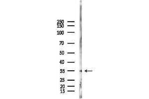 anti-Axin Interactor, Dorsalization Associated (AIDA) antibody