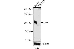 Western blot analysis of extracts from normal (control) and SUZ12 knockout (KO) HeLa cells, using SUZ12 antibody (ABIN6127300, ABIN6148752, ABIN6148754 and ABIN7101816) at 1:1000 dilution. (SUZ12 Antikörper  (AA 470-739))
