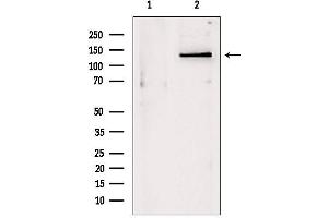 Western blot analysis of extracts from Mouse myeloma, using DHX9 antibody. (DHX9 Antikörper  (C-Term))