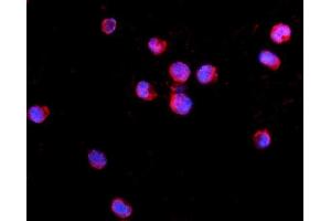 IF analysis of IL2 Receptor gamma/IL2RG using anti-IL2 Receptor gamma/IL2RG antibody (ABIN7603175).