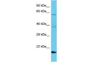 Host: Rabbit Target Name: TMBIM1 Sample Type: Jurkat Whole Cell lysates Antibody Dilution: 1. (TMBIM1 Antikörper  (N-Term))