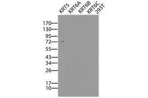 Image no. 2 for anti-Keratin 5 (KRT5) (AA 1-273) antibody (ABIN1490697) (Cytokeratin 5 Antikörper  (AA 1-273))