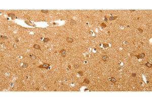Immunohistochemistry of paraffin-embedded Human brain tissue using MAP1B Polyclonal Antibody at dilution 1:60 (MAP1B Antikörper)