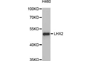 Western blot analysis of extracts of H460 cells, using LHX2 antibody (ABIN4904227) at 1:1000 dilution. (LHX2 Antikörper)