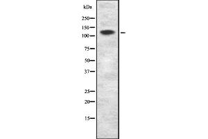 Western blot analysis of MCF2L expression in Molt-4 whole cell lysate,The lane on the left is treated with the antigen-specific peptide. (MCF2L Antikörper  (Internal Region))