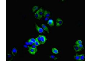 Immunofluorescent analysis of MCF-7 cells using ABIN7148290 at dilution of 1:100 and Alexa Fluor 488-congugated AffiniPure Goat Anti-Rabbit IgG(H+L) (TMEM27 Antikörper  (AA 15-141))