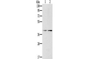 Gel: 8 % SDS-PAGE, Lysate: 40 μg, Lane 1-2: Hela cells, lovo cells, Primary antibody: ABIN7130569(PDGFRL Antibody) at dilution 1/400, Secondary antibody: Goat anti rabbit IgG at 1/8000 dilution, Exposure time: 10 minutes (PDGFRL Antikörper)