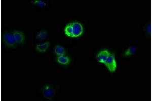 Immunofluorescence staining of MCF-7 cells with ABIN7169039 at 1:166, counter-stained with DAPI. (DCLK1 Antikörper  (AA 143-381))
