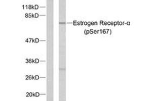 Western blot analysis of extracts from MCF7 cells treated with EGF, using Estrogen Receptor-alpha (Phospho-Ser167) Antibody. (Estrogen Receptor alpha Antikörper  (pSer167))