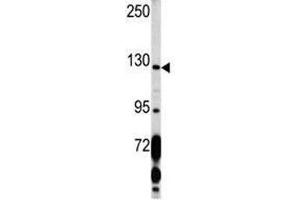 Western blot analysis of PDGFRA antibody and K562 lysate. (PDGFRA Antikörper  (AA 1048-1077))
