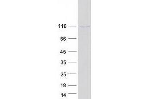 Validation with Western Blot (FAM179A Protein (Myc-DYKDDDDK Tag))