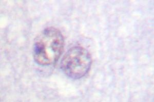 Image no. 1 for anti-Sp1 Transcription Factor (SP1) antibody (ABIN272083) (SP1 Antikörper)