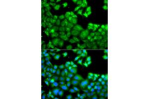 Immunofluorescence analysis of A549 cells using NLRC4 antibody (ABIN5975127). (NLRC4 Antikörper)