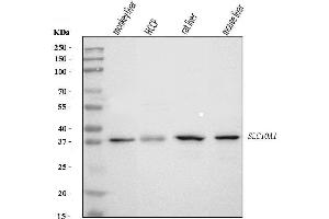 Western blot analysis of SLC10A1/NTCP1 using anti-SLC10A1/NTCP1 antibody (ABIN7599990).