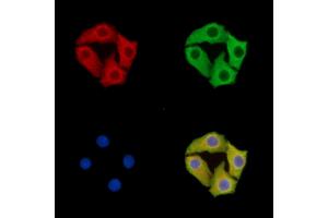 anti-Keratinocyte Associated Protein 2 (KRTCAP2) antibody