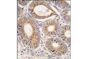 Immunohistochemistry (Paraffin-embedded Sections) (IHC (p)) image for anti-Fibroblast Growth Factor 1 (Acidic) (FGF1) (N-Term) antibody (ABIN358985)