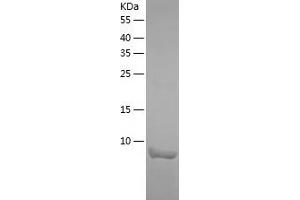 Western Blotting (WB) image for Chemokine (C-C Motif) Ligand 4 (CCL4) (AA 24-92) (Active) protein (His tag) (ABIN7122302)