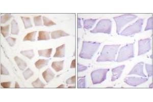Immunohistochemistry analysis of paraffin-embedded human skeletal muscle tissue, using CRYAB (Ab-59) Antibody.