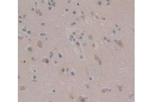 IHC-P analysis of Human Tissue, with DAB staining. (AXIN2 Antikörper  (AA 350-631))