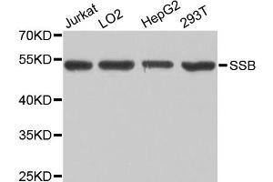 Western blot analysis of extracts of various cell lines, using SSB antibody (ABIN1874948) at 1:1000 dilution. (SSB Antikörper)