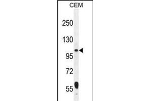 LARS2 Antibody (Center) (ABIN655050 and ABIN2844678) western blot analysis in CEM cell line lysates (35 μg/lane). (LARS2 Antikörper  (AA 418-446))