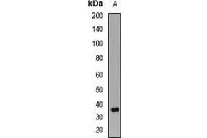 Western blot analysis of PPP2CB expression in Jurkat (A) whole cell lysates. (PPP2CB Antikörper)