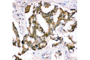 IHC analysis of Crk p38 using anti-Crk p38 antibody (ABIN3042758).