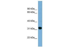 Carbonyl Reductase 1 antibody used at 1 ug/ml to detect target protein. (CBR1 Antikörper  (Middle Region))